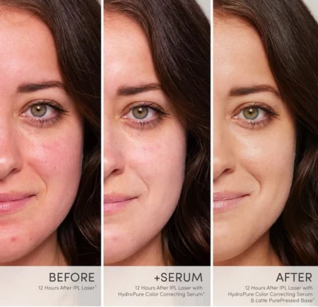 Before and after images showing HydroPure serum results and full makeup, with reduced redness, smoother skin and more even tone.