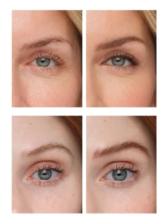 Before and after brow close-ups showing deeper colour and more defined shape after PureBrow Brow Gel.