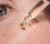 Clear serum applied with a pipette to the cheek area, showing skin texture and a lightweight skincare application.