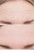Before-and-after forehead comparison showing smoother-looking skin after treatment.