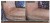 Before-and-after forearm skin comparison after starting the Environ Body EssentiA set.