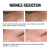 Before-and-after eye and lip area images showing visible line reduction after 4 and 12 weeks.