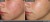 Before-and-after images of the same female face showing results of Environ Clarity treatment.