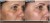 Close-up before-and-after images of facial skin after using Environ Focus Care Radiance products.