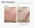 Before-and-after skin comparison after 14 weeks of Skin Omegas+ use, showing smoother and more hydrated-looking skin.