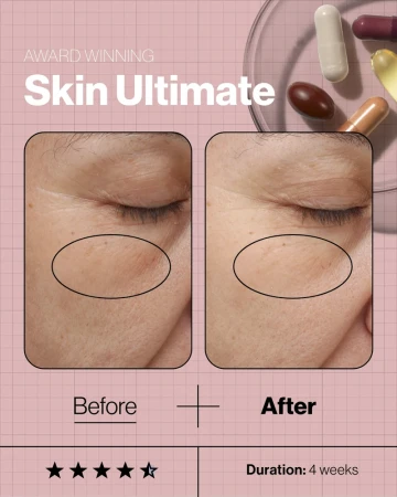 Skin Ultimate promotional graphic showing a 4-week skincare supplement programme and product rating.