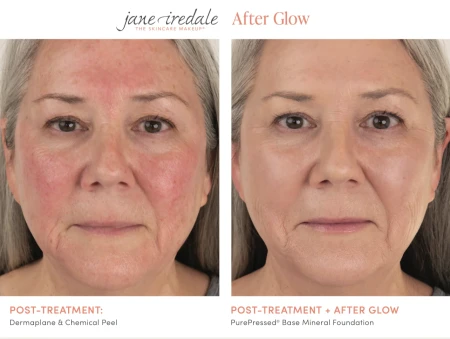 Before and after Jane Iredale After Glow makeup result showing a more even-looking finish.