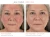 Before and after Jane Iredale After Glow makeup result showing a more even-looking finish.